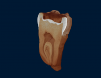 tooth 3D List